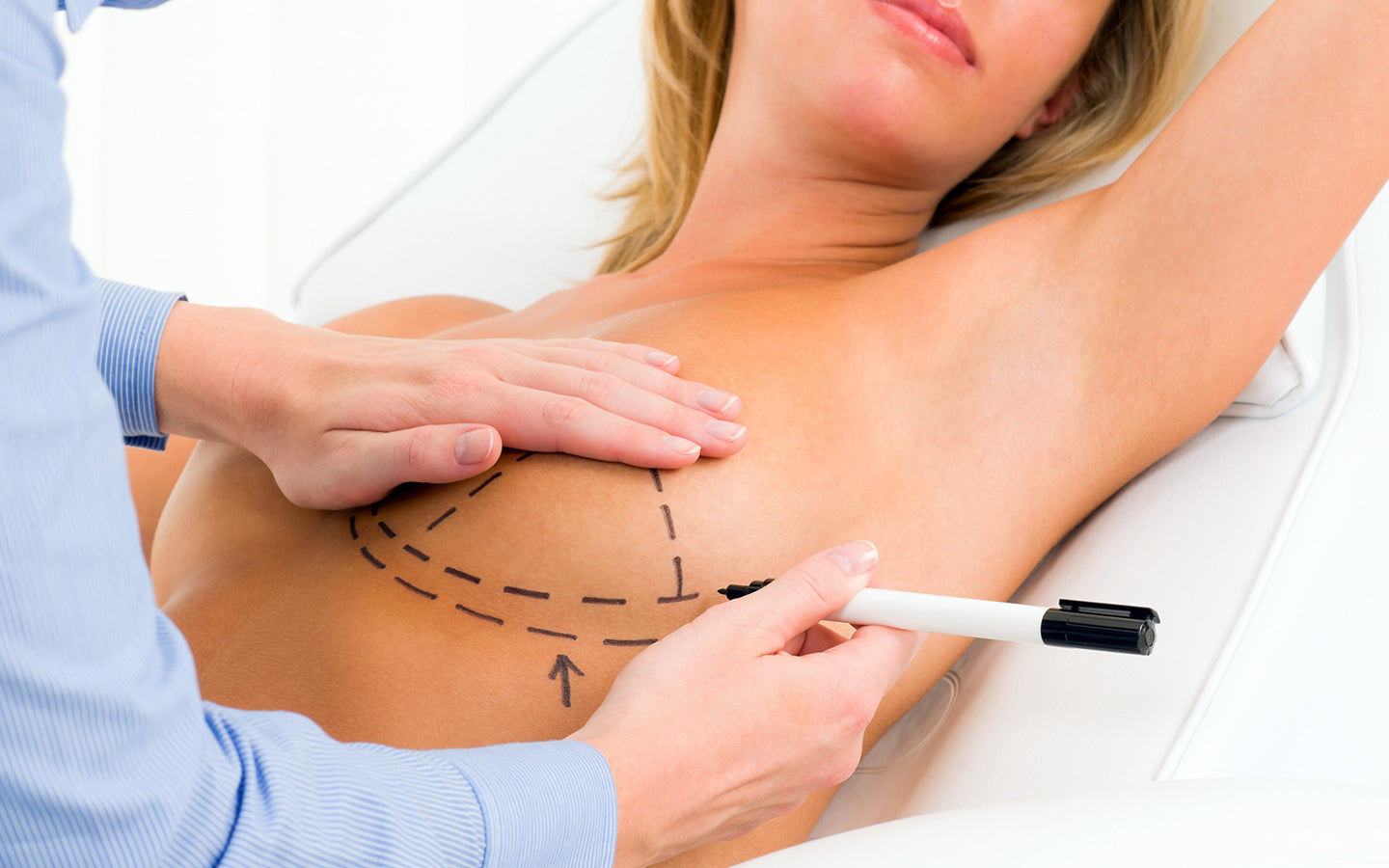 Implante de silicone ou mastopexia?