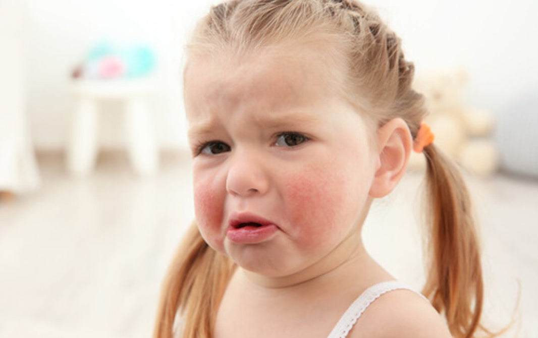 Testes de alergia: quais os tipos e as indicações?