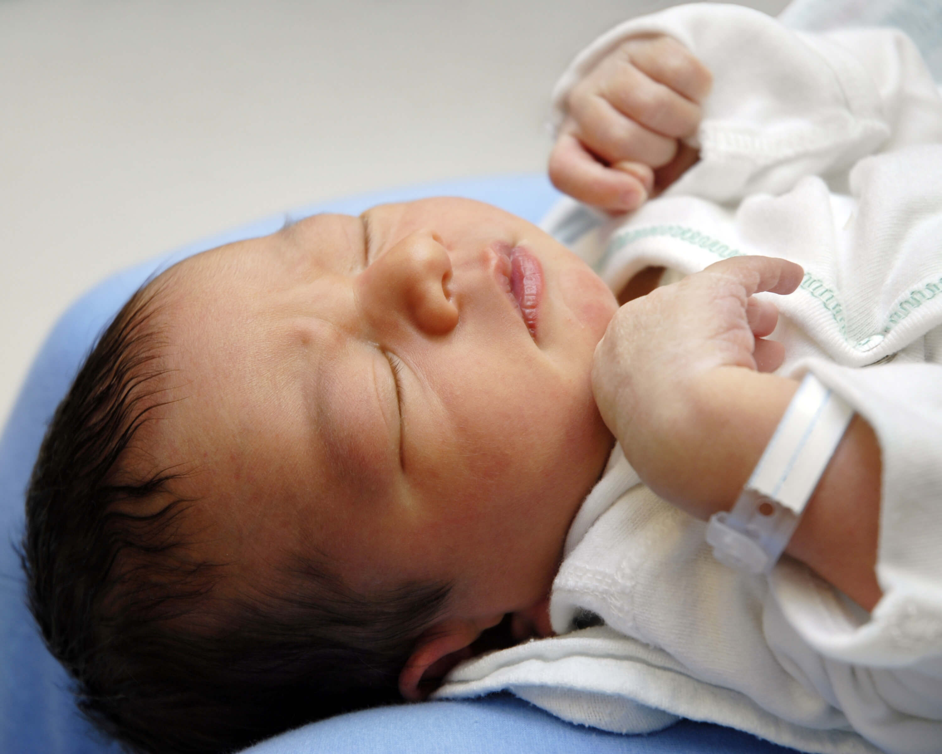 Quais são as cirurgias mais realizadas em recém-nascidos?