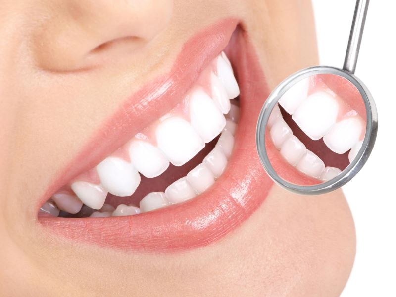 Lentes de contato dental transformam sorrisos