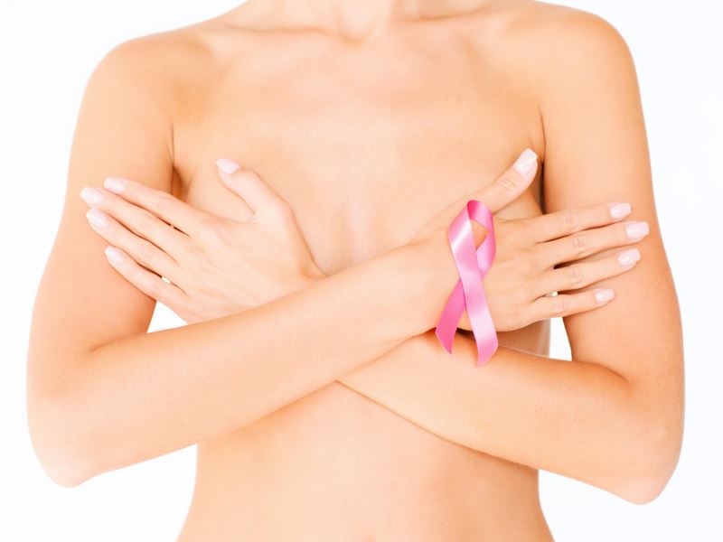 Tudo o que você precisa saber sobre o câncer de mama