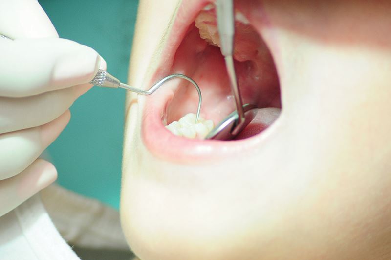 Quando aparecem os dentes permanentes?
