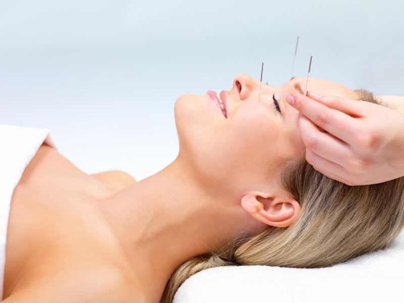 Benefícios da acupuntura para gestantes