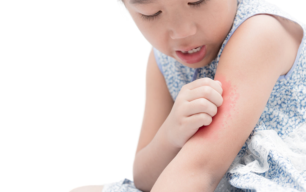 Molusco contagioso e outras doenças de pele comuns em crianças
