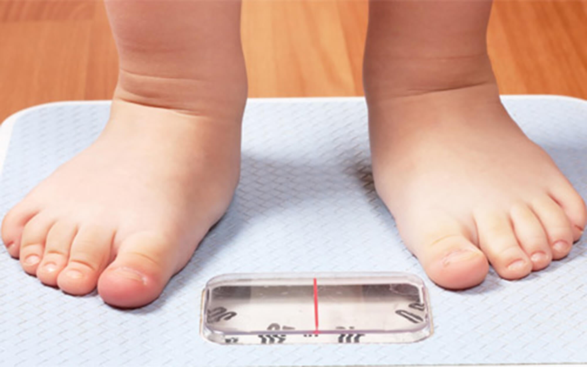 Os riscos da obesidade na infância